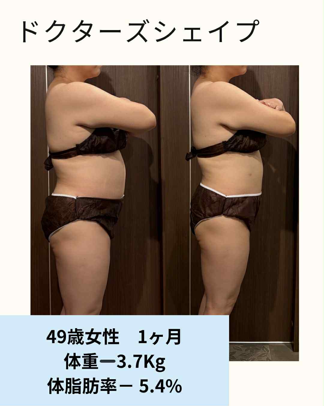 49歳女性 ビフォーアフター